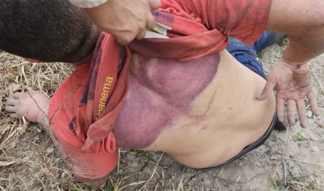 eunapolis-motorista-por-aplicativo-e-sequestrado-e-torturado-por-traficantes-apos-ser-confundido-com-informante