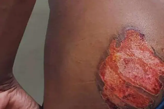 Filhos de empresários são presos por torturar jovem com ferro quente no sudoeste da Bahia.