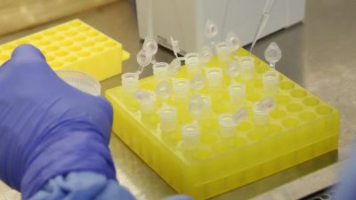 sp-confirma-segundo-caso-importado-de-sarampo