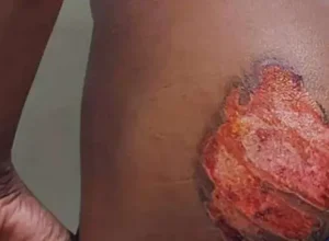 Filhos de empresários são presos por torturar jovem com ferro quente no sudoeste da Bahia.