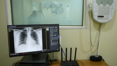 diagnosticos-evoluem,-mas-lei-do-imposto-de-renda-ainda-ignora-doencas