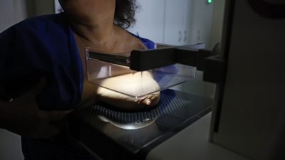 ans-defende-que-plano-cubra-mamografia-digital-sem-restricao-de-idade