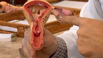 aberta-chamada-publica-para-pesquisas-sobre-endometriose