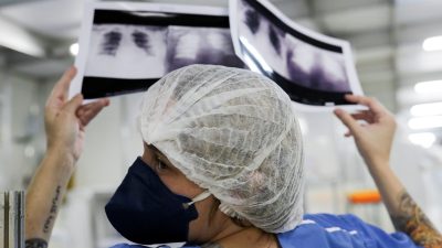 diagnostico-tardio-da-poucas-chances-de-cura-para-o-cancer-de-pulmao