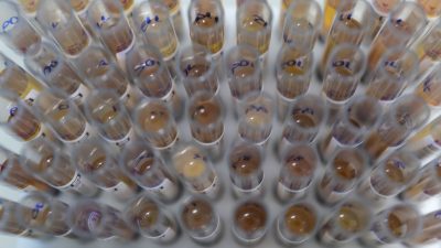 uso-de-medicamento-oferecido-no-sus-reduz-casos-de-malaria-no-brasil