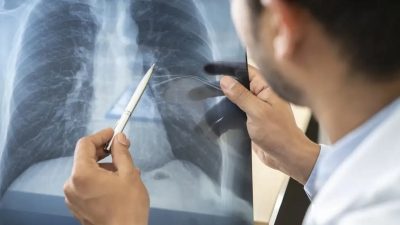 tabagismo-e-maior-entre-jovens-de-16-a-24-anos,-alerta-pesquisa
