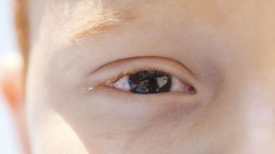 baixa-visao-na-infancia:-especialista-alerta-para-diagnostico-precoce