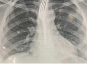 WhatsApp-Image-2025-09-30-at-08.58.54-548x365-1